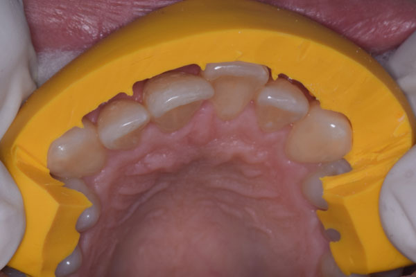 Smile Design and Treatment Planning