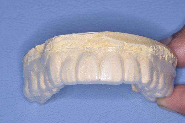 Smile Design and Treatment Planning