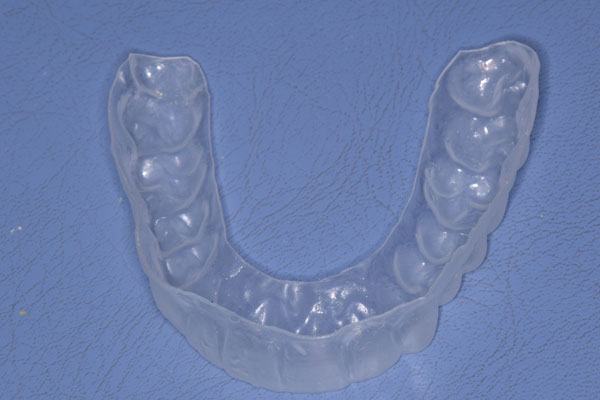 Smile Design and Treatment Planning