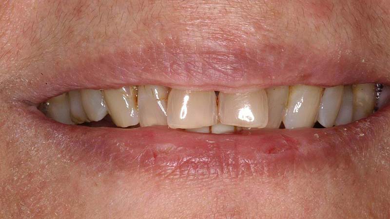 Smile Analysis Workshop
